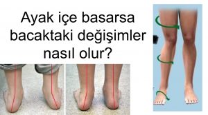 Yaz mevsiminde çocukların en sevdiği aktivitelerin başında gelen paten, doğru