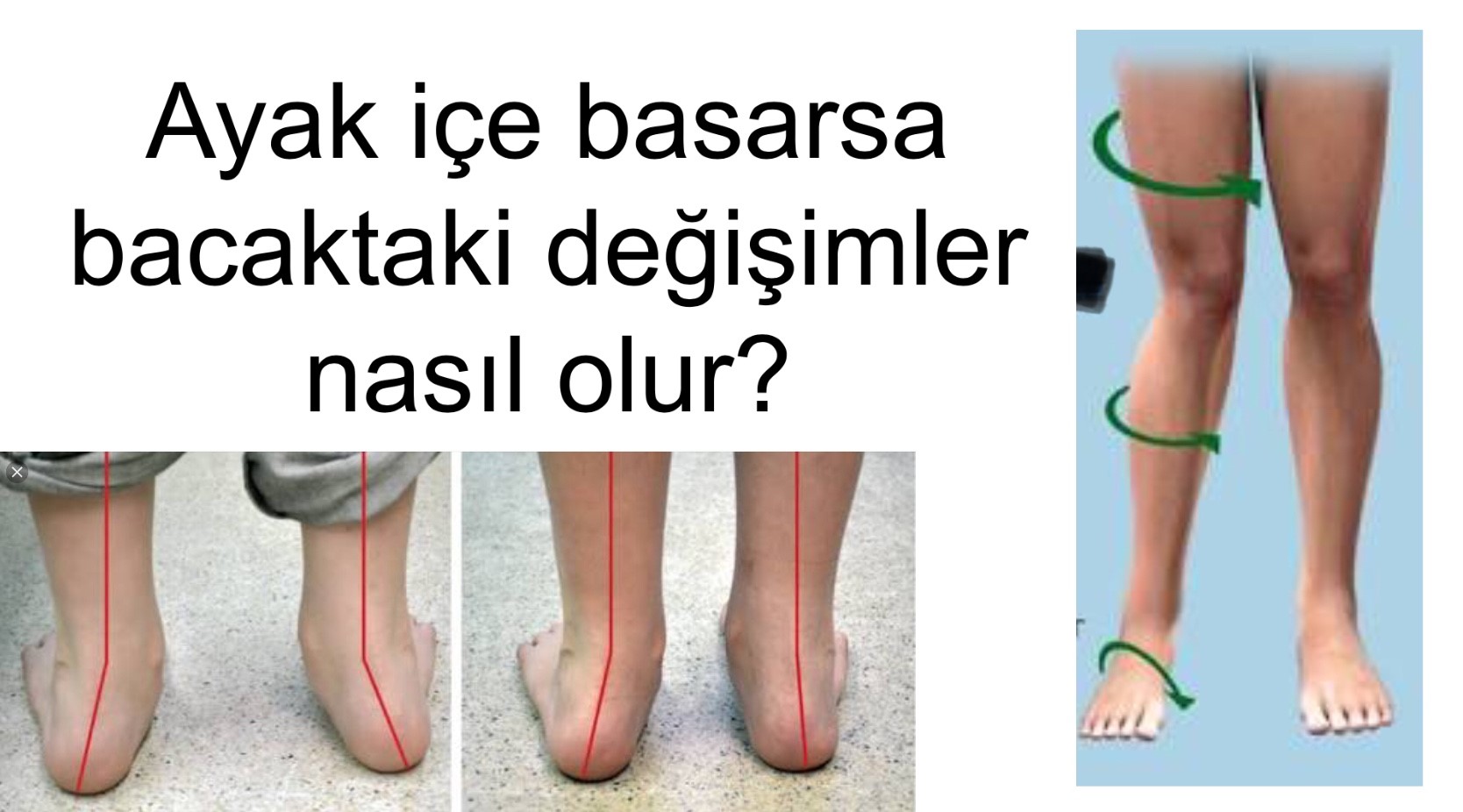 Yaz mevsiminde çocukların en sevdiği aktivitelerin başında gelen paten, doğru
