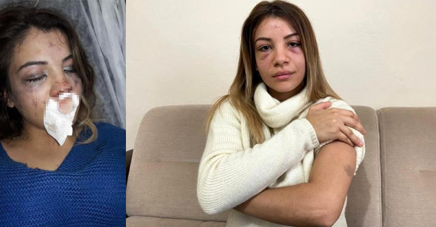 Üsküdar’da 4 aylık hamile olan 18 yaşındaki Aslınur Ö., 3