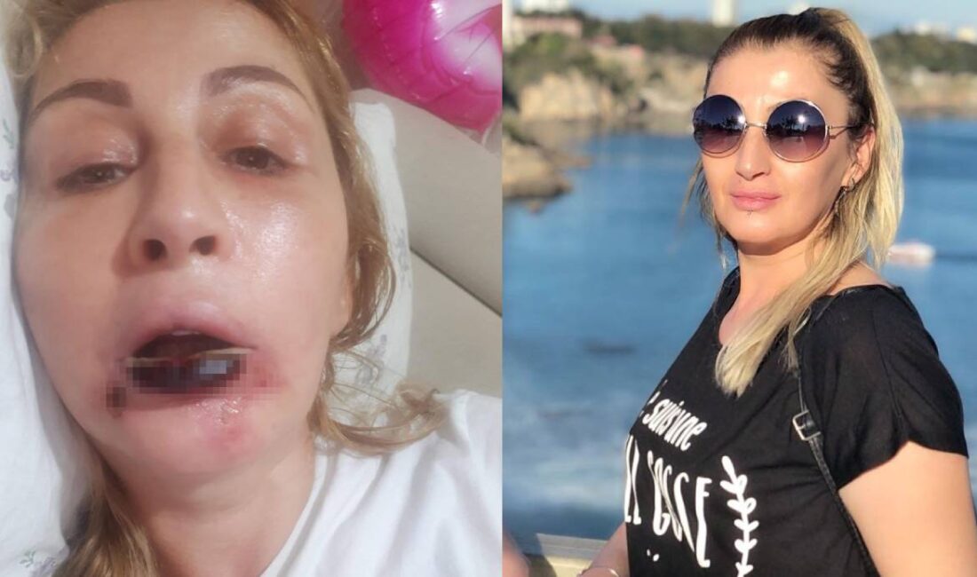 Antalya’da 2019 yılında bıçak altına yatan 3 çocuk annesi ve