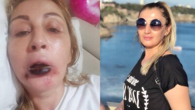 Antalya’da 2019 yılında bıçak altına yatan 3 çocuk annesi ve