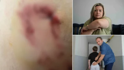 Bolu’da asansörden inen 7 yaşındaki çocuk, komşusuna ait Belçika kurdu